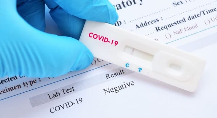 Covid-19: ANS torna obrigatória cobertura de teste por planos de saúde